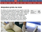 Amputace prstu na noze