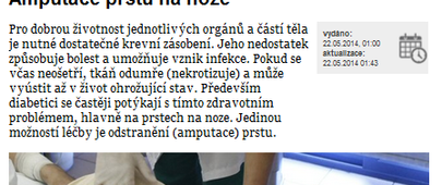 Amputace prstu na noze