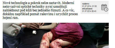 (Ne)obyčejné světlo jako urychlovač hojení ran?