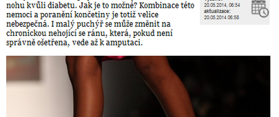 S diabetem zapomeňte na podpatky!