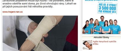 Závažnost popáleniny určuje, jak se tělo zachová